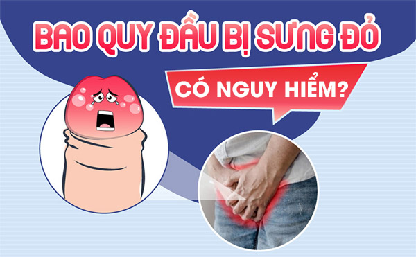 Tuột bao quy đầu bị sưng phồng có nguy hiểm không?