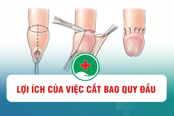 Cắt bao quy đầu quan hệ có sướng hơn không?