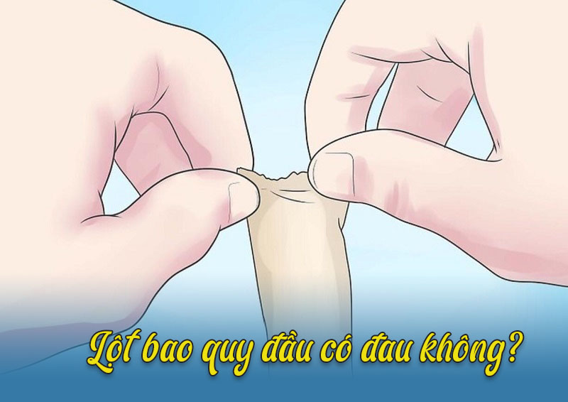 Mấy tuổi lột bao quy đầu – Lột bao quy đầu có đau không?