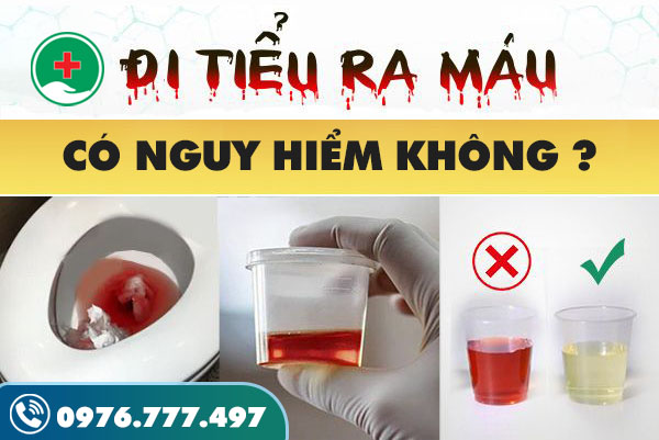 Đi tiểu ra máu ở nam giới có thật sự nguy hiểm không?